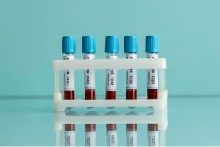 Home Lab Tests
